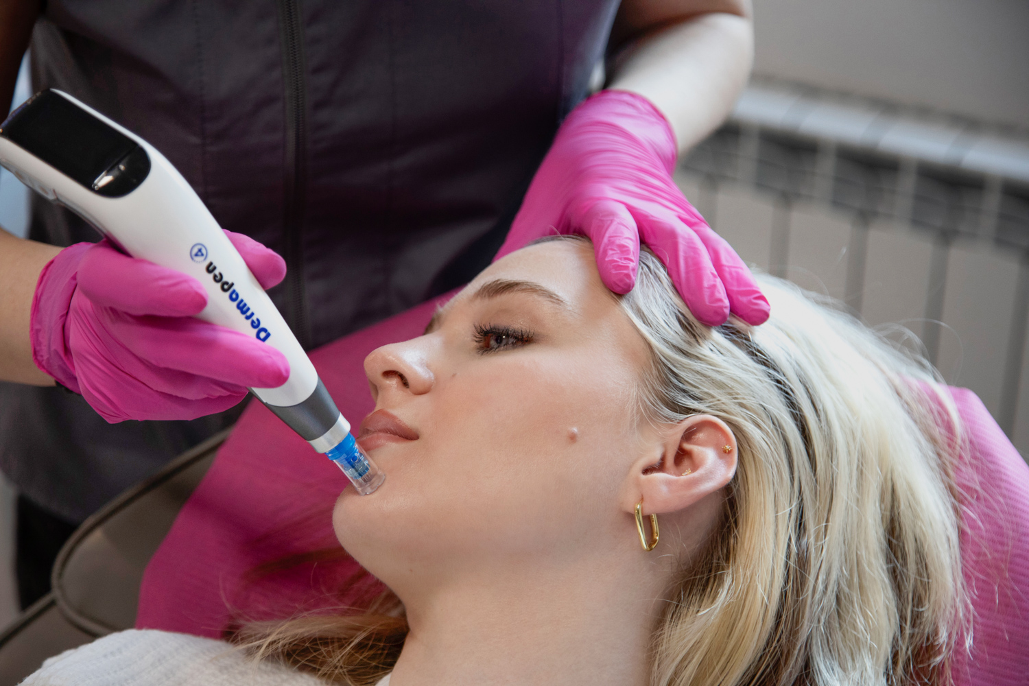 dermapen