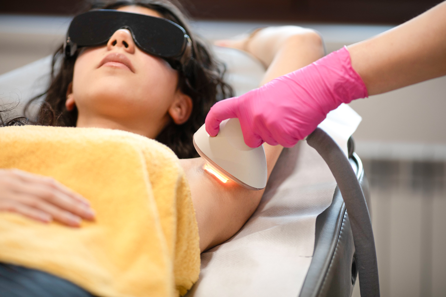 epilare definitiva ipl